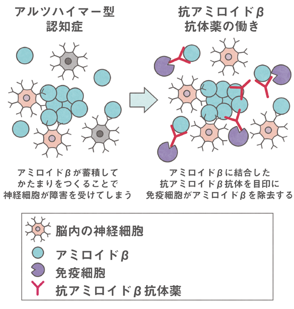 抗アミロイドβ抗体薬の作用機序