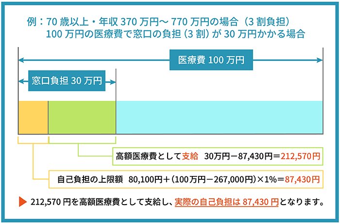 高額療養費制度　70歳以上の方の自己負担額の例